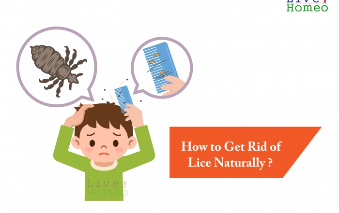 How to get rid of Lice Naturally