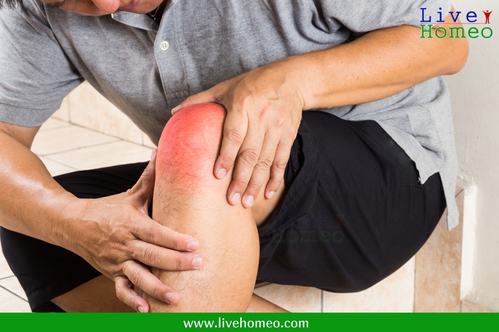 Joint Pains Treatment in Homeopathy