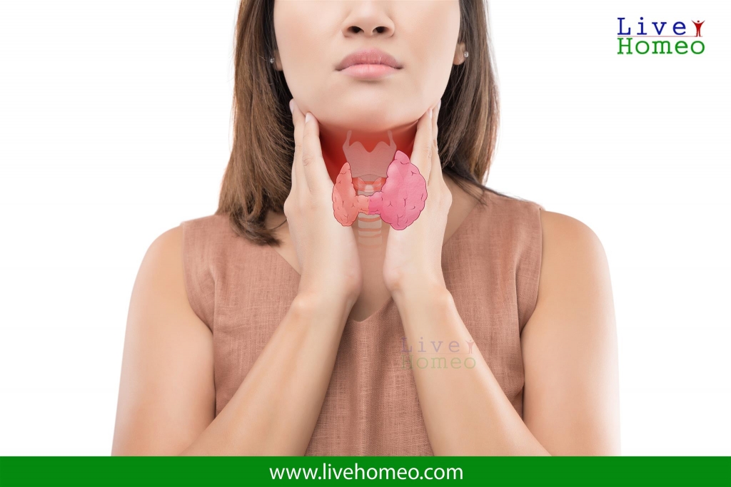 Goiter Treatment in Homeopathy
