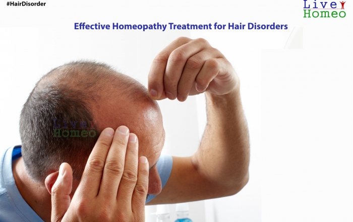 Effective Homeopathy Treatment for Hair Disorders